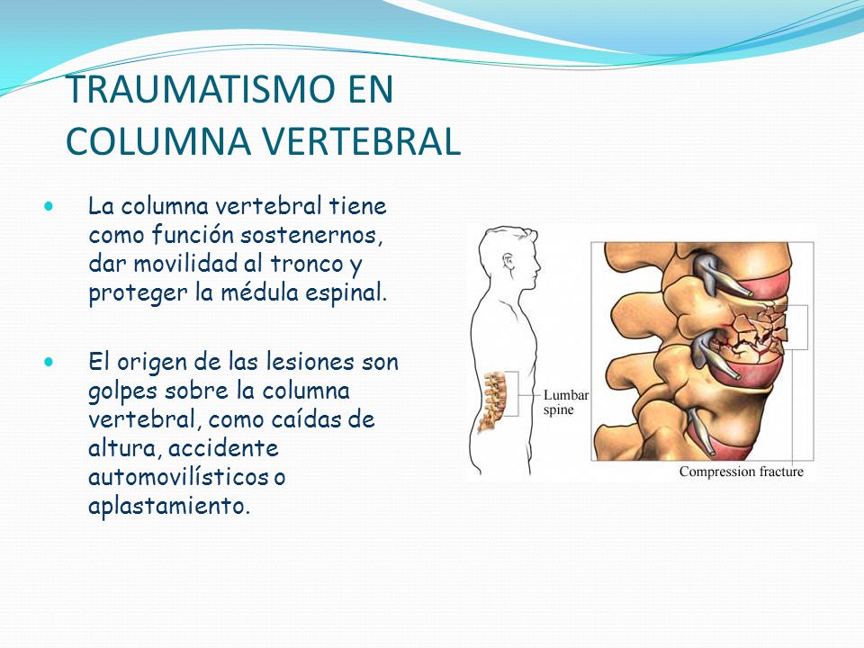 Los indicios el síndrome doloroso la osteocondrosis